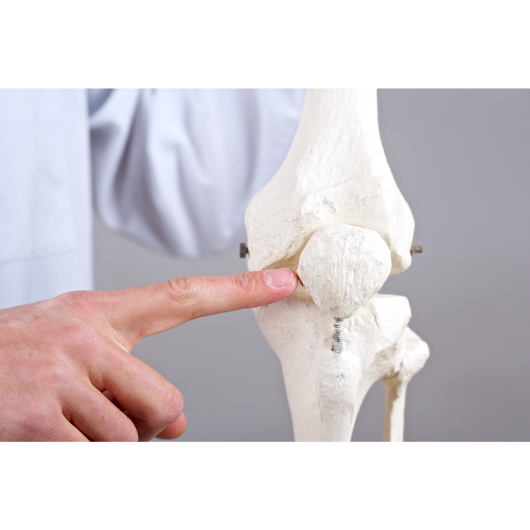 Condromalacia rotuliana