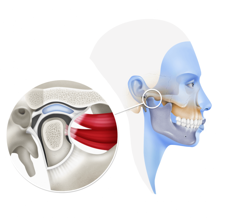 Articulación temporo-mandibular